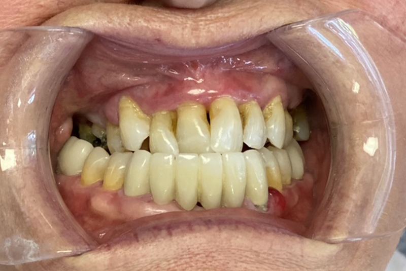 patient's before smile