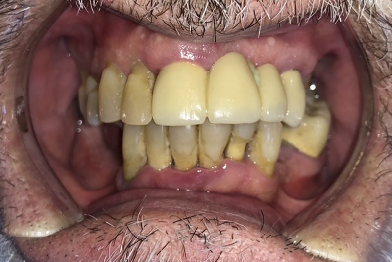 patient's before smile